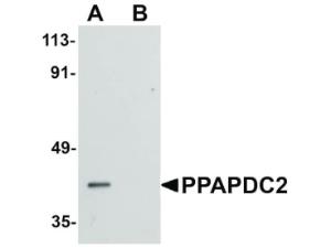 PPAPDC2 antibody 100 µg