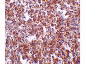 Anti-METTL7B (Rabbit) antibody 100 μg