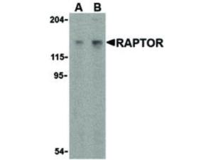 Raptor antibody (rabbit) 100 µg