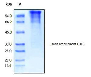 Human recombinant LDLR