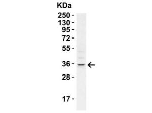 RHBDD1 antibody 100 µg