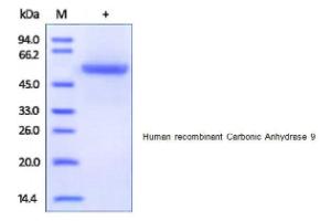 Human recombinant Carbonic Anhydrase 9