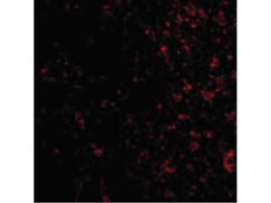 PAK4 antibody 100 μg