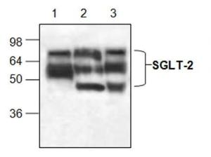Western-Blot-Analyse von SGLT-2 in Lysat von Jurkat-Zellen (Spur 1), Maus-Dünndarm (Spur 2) und Rattenniere (Spur 3).