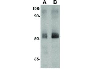 SPred2 antibody 100 μg