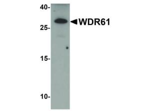 WDR61 antibody 100 μg