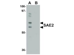 SAE2 antibody 100 µg