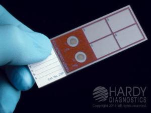 Q-Slide™ AFB, Prepared Control Slide for QC of AFB Stain, Hardy Diagnostics