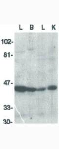 ICAD antibody (ELISA/WB) 100 μg