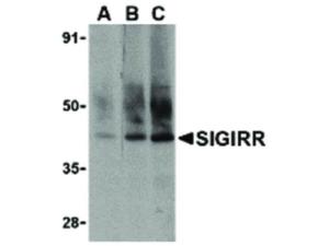 SIGIRR antibody 100 µg