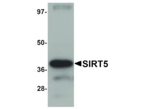 SIRT5 antibody 100 µg