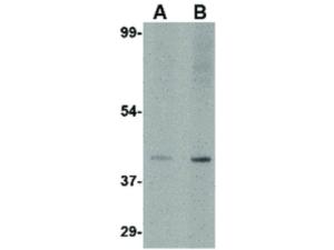 SLC35D1 antibody 100 µg
