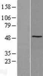 SSB Overexpression Lysate (Adult Normal), Novus Biologicals (NBL1-16464)