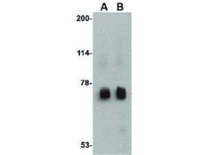 RKHD2 antibody 100 μg