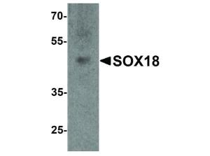 SOX18 antibody 100 µg