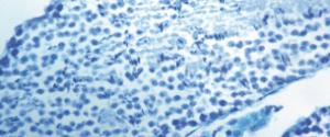 Solvent Blue 38 kit stain for histology
