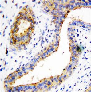 Anti-BCAT1 Rabbit Polyclonal Antibody
