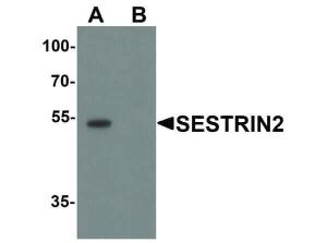 SESTRIN2 antibody 100 μg