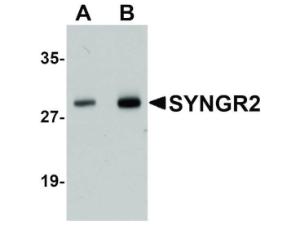 SYNGR2 antibody 100 µg