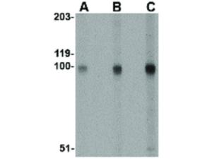 STIM2 (Rabbit) antibody 100 μg