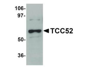 TCC52 antibody 100 µg