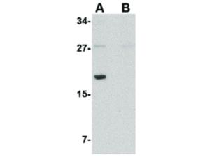 MED28 antibody 100 μg