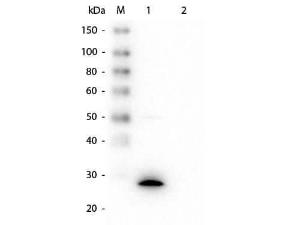 GSTZ1 antibody 100 μg