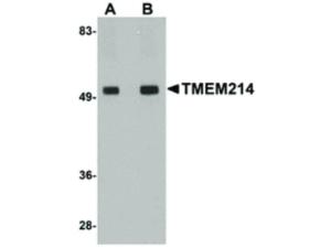 TMEM214 antibody 100 µg