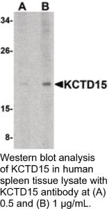 Anti-KCTD15 Rabbit Polyclonal Antibody