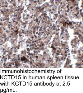 Anti-KCTD15 Rabbit Polyclonal Antibody