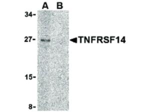 TNFRSF14 (rabbit) antibody 100 µg