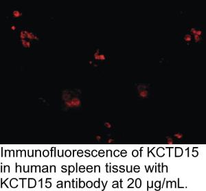 Anti-KCTD15 Rabbit Polyclonal Antibody