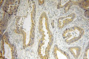 Anti-ACAD9 Rabbit Polyclonal Antibody