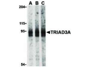 TRIAD3A antibody 100 µg