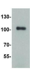 TRIM28 antibody 100 µg