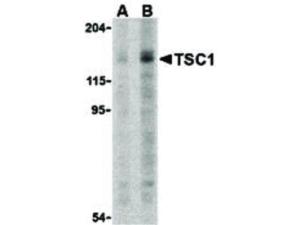 TSC1 (rabbit) antibody 100 µg
