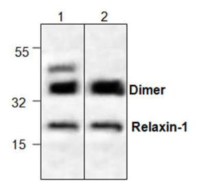 Western-Blot-Analyse von Relaxin-1 mit Jurkat-Zelllysat (Spur 1) und Rattennieren-Gewebelysat (Spur 2).