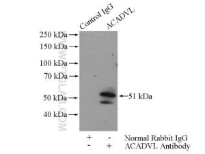 Anti-ACADVL Rabbit Polyclonal Antibody