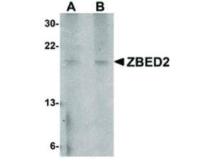 ZBED2 antibody 100 µg