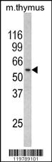 Anti-RCBTB2 Rabbit Polyclonal Antibody