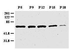 ZIC-1 antibody 25 µl