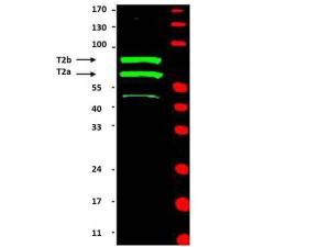 Anti-cyclin T2 [Rabbit] 100 μl