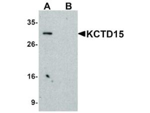 KCTD15 antibody 100 µg