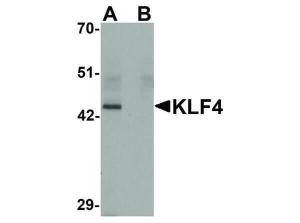 KLF4 antibody (4E5C3) 100 µg