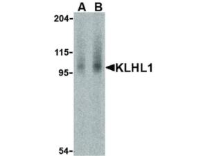 KLHL1 antibody 100 µg