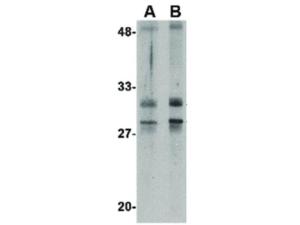 Anti-METTL7A (RB) antibody 100 µg