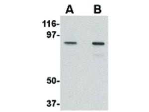 NUP107 (rabbit) antibody 100 µg