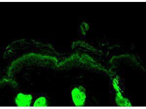 Caleticullin antibody 200 μl