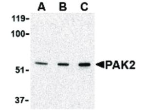 PAK2 antibody 100 µg