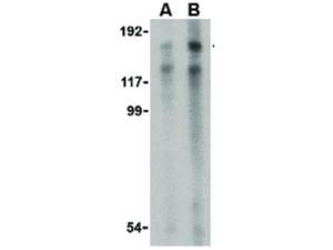 TRBP1 antibody 100 µg